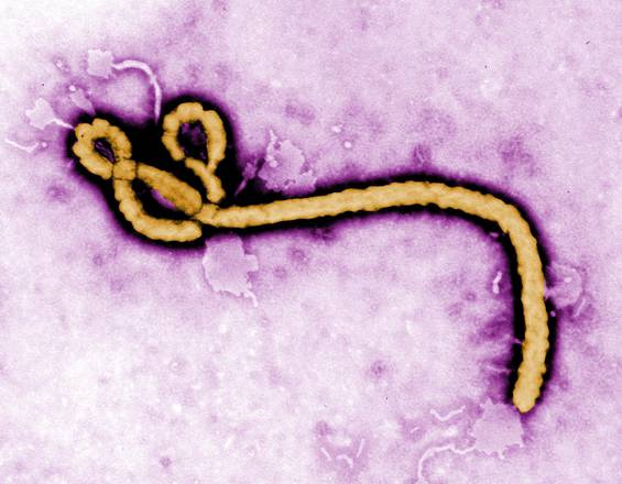 Virus 'killer', spegnere una molecola può renderli innocui