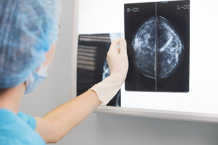 Tumore seno, diagnosi più precise con l'Intelligenza artificiale