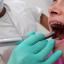 Ortodonzisti, il sorriso dei bimbi può essere la spia di problemi